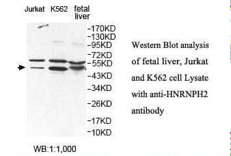 HNRNPH2 / hnRNP H2 Antibody (aa37-302)