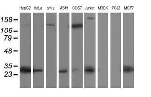 SIRT5 / Sirtuin 5 Antibody (clone OTI1A6, Carrier-free)