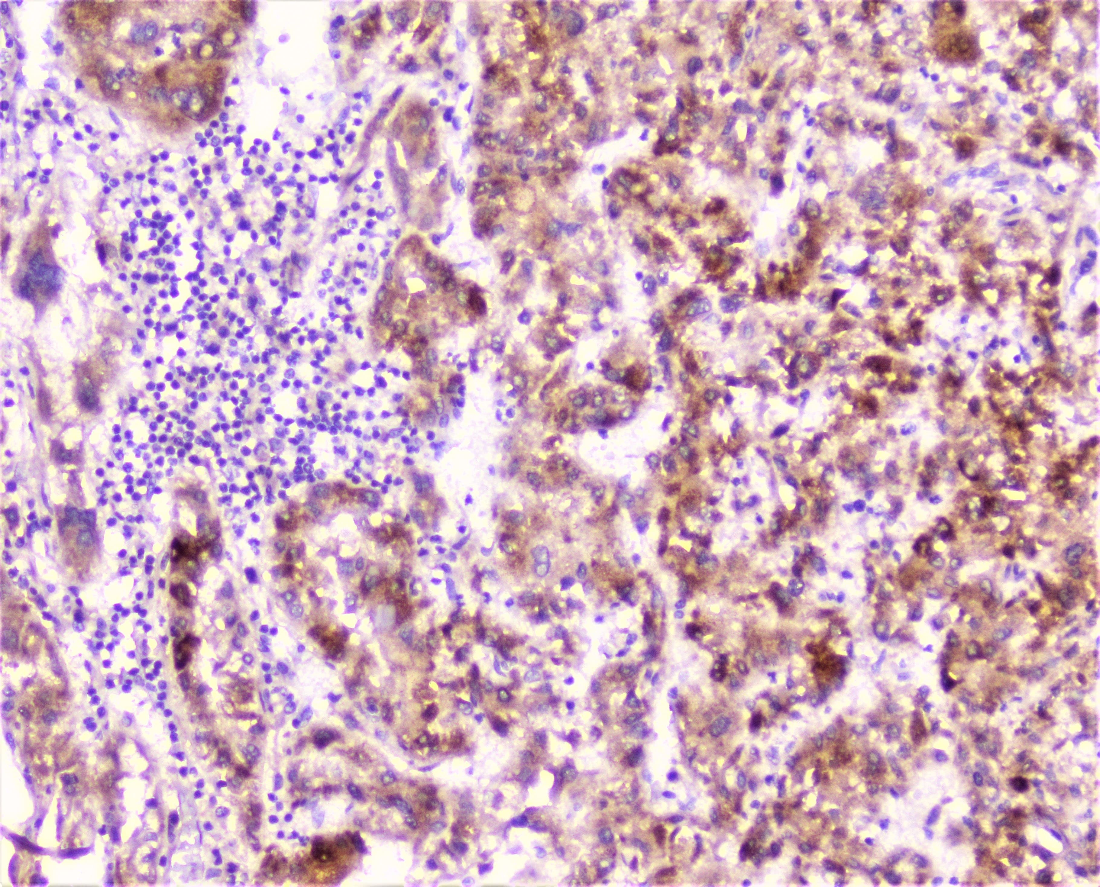 CRP / C-Reactive Protein Antibody