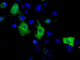 ACAT2 Antibody (clone OTI3C9)