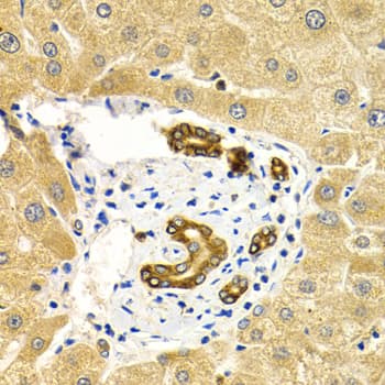 RAB27A / RAB27 Antibody