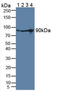 PLG / Plasmin / Plasminogen Antibody (aa274-560)