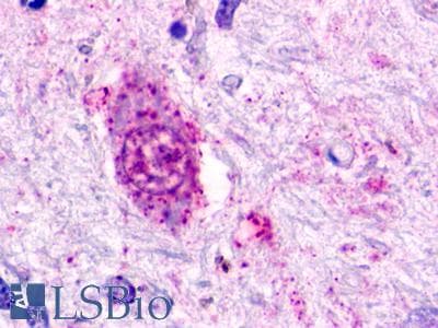 PathPlus™ GPR84 Antibody (Transmembrane Domain)