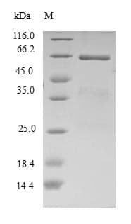 Human EIF2B2 Protein (Recombinant GST, N-terminus)