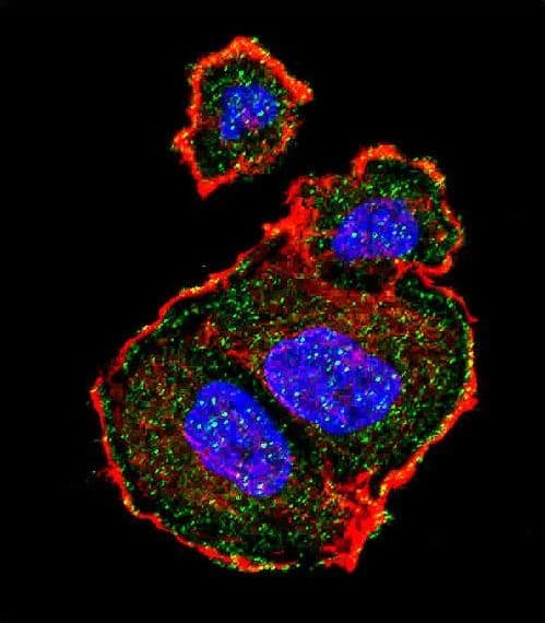 Tuberin / TSC2 Antibody (phospho-Ser939)