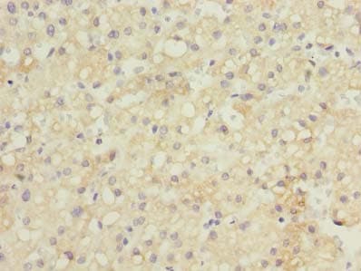 GDF2 / BMP9 Antibody (aa300-429)
