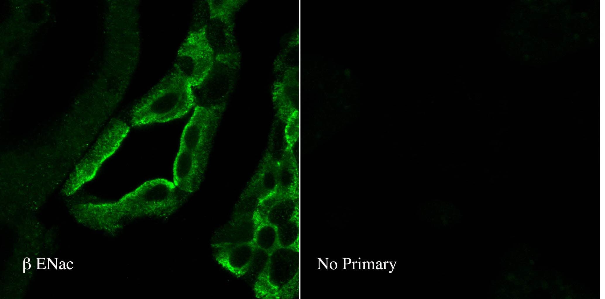 SCNN1B / ENaC Beta Antibody (aa617-638, Biotin)