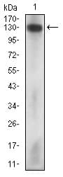 PathPlus™ MCAM / CD146 Antibody (aa84-189, clone 6C3F1)