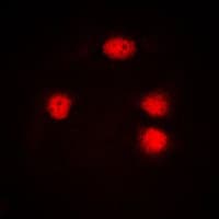 Polyclonal Rabbit anti-Human ELF5 Antibody (C-Terminus, IF, WB)