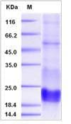 Human CD3E Protein (Recombinant His,C-terminus)