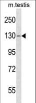 TBC1D2 Antibody (aa438-465)