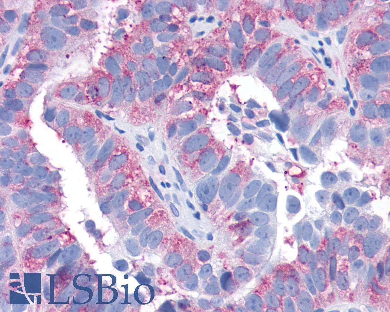 PathPlus™ SIPR3 / EDG3 / S1P3 Antibody (N-Terminus)