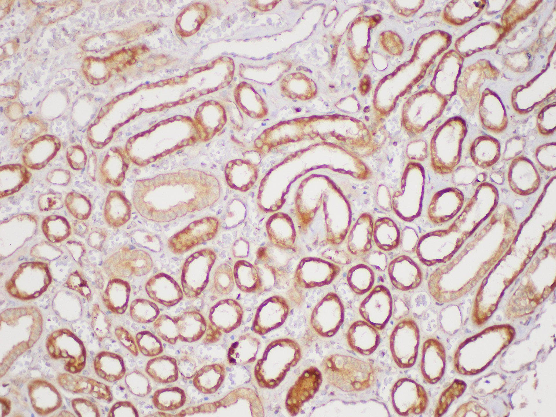 SERPINB2 / PAI-2 Antibody