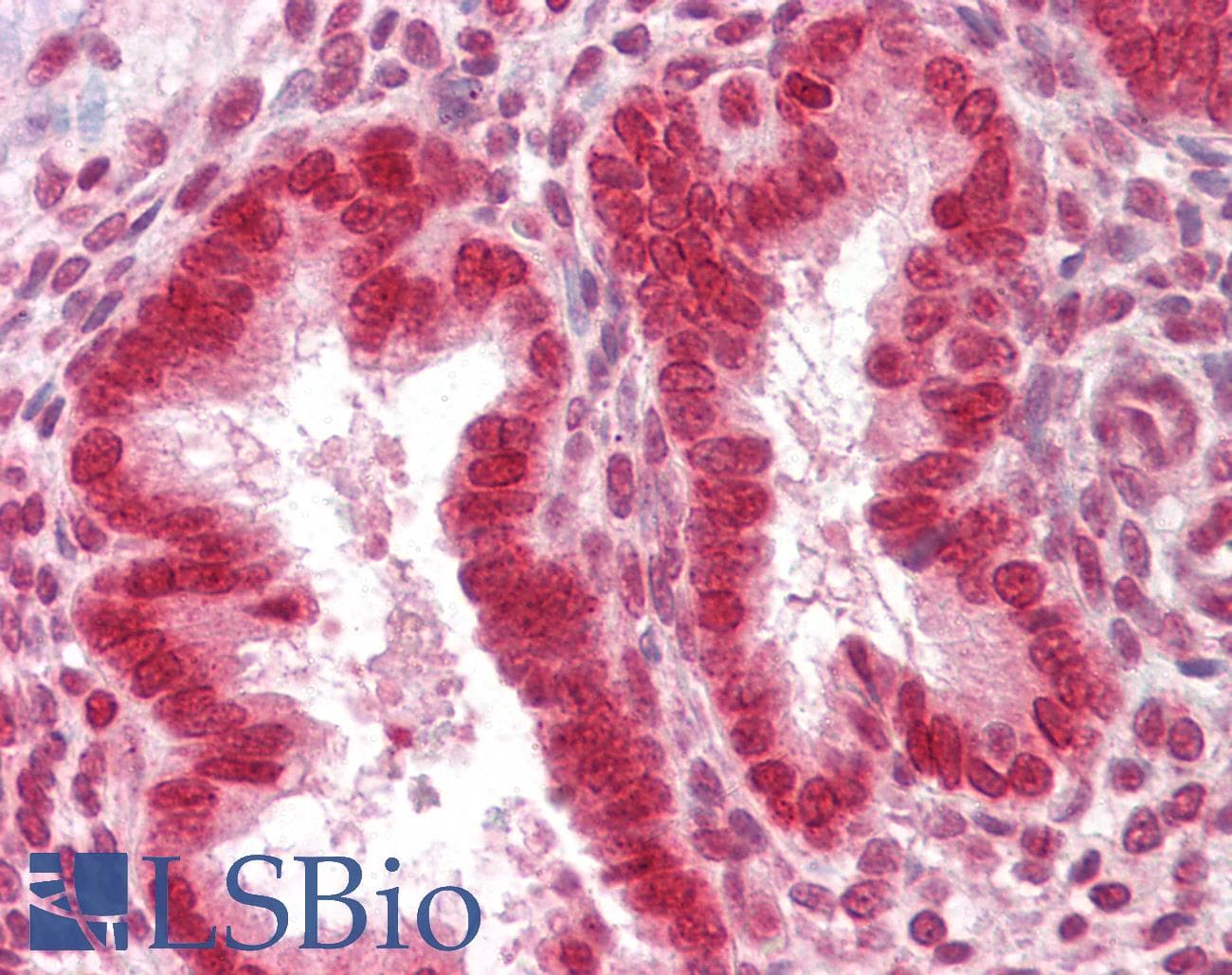 IHC-plus™ Polyclonal Rabbit anti-Human SUMO1 / SMT3 Antibody (aa1-50, IHC, IF, WB)