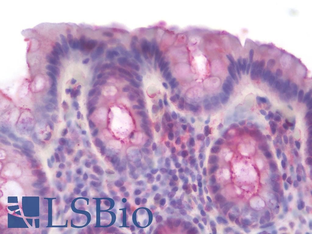 IHC-plus™ EMA / MUC1 Antibody