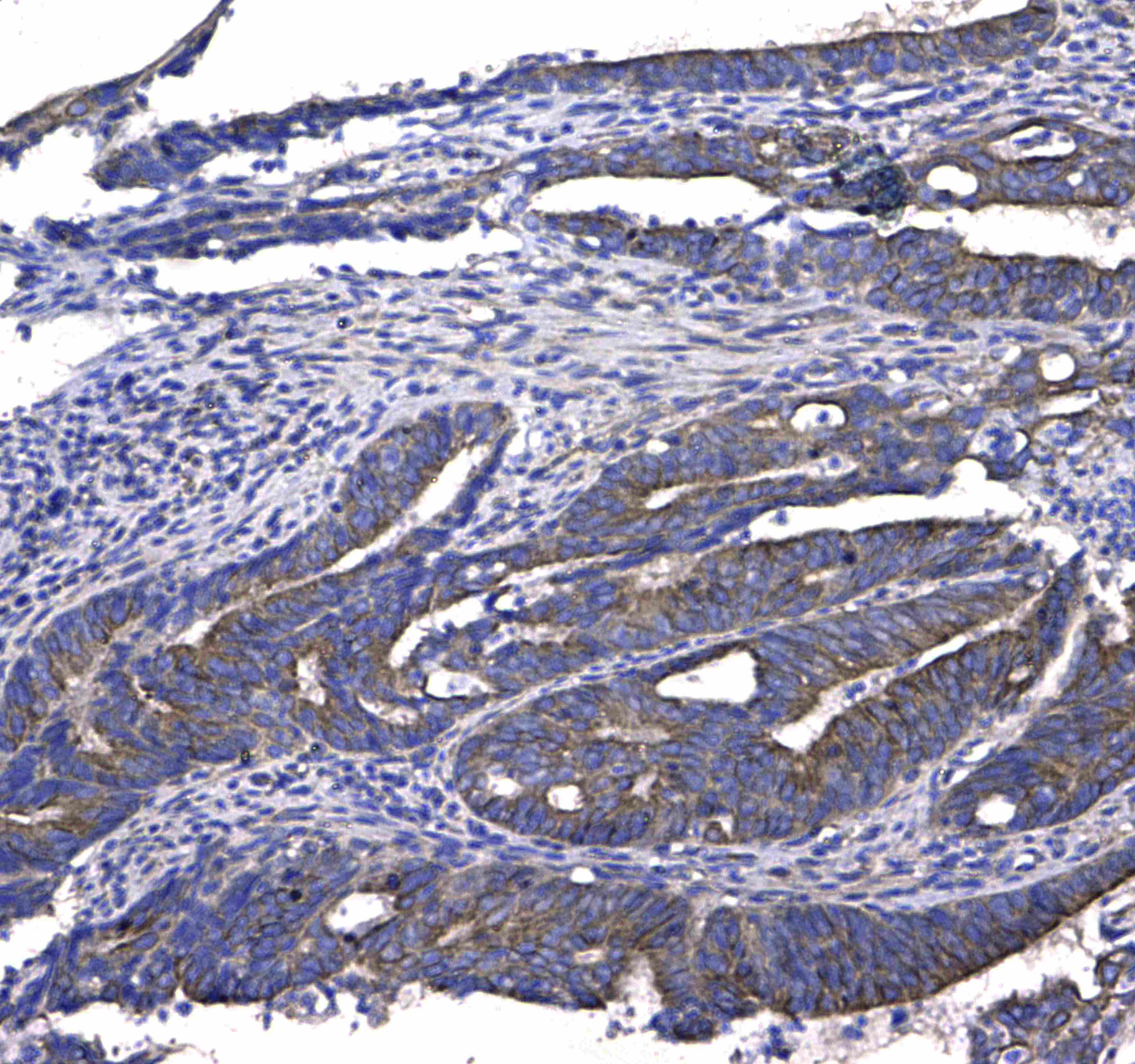 GSTM3 Antibody
