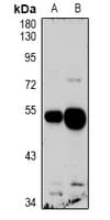 Polyclonal Rabbit anti-Human QRFPR / GPR103 Antibody (WB)