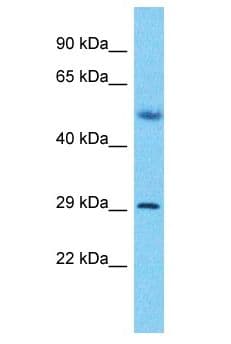 Polyclonal Rabbit anti-Human SLX1A / GIYD2 Antibody (aa222-271, WB)