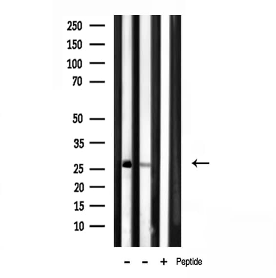 Polyclonal Rabbit anti-Human MRPL16 Antibody (IHC, IF, WB)