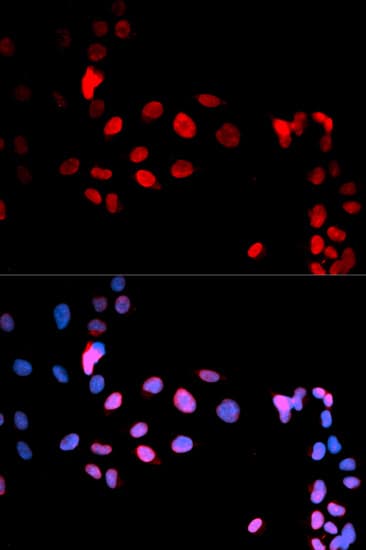 MAX Antibody (phospho-Ser11)