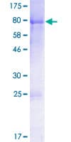 Human DVL1 / DVL / Dishevelled Protein (Recombinant GST)