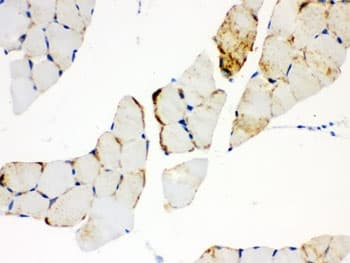 CPT1B Antibody