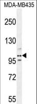 PEAR1 Antibody (aa961-990)