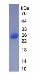 Human IFN Beta / Interferon Beta Protein (Recombinant His-T7)
