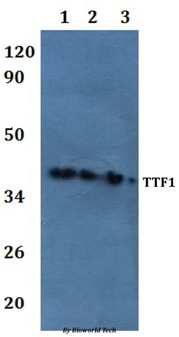 Polyclonal Rabbit anti-Human TTF1 / Txn Termination Factor Antibody (WB)