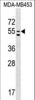 Polyclonal Rabbit anti-Human PTDSS1 Antibody (aa390-418, WB)