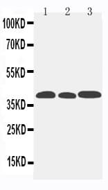 CCR5 Antibody (aa181-199)