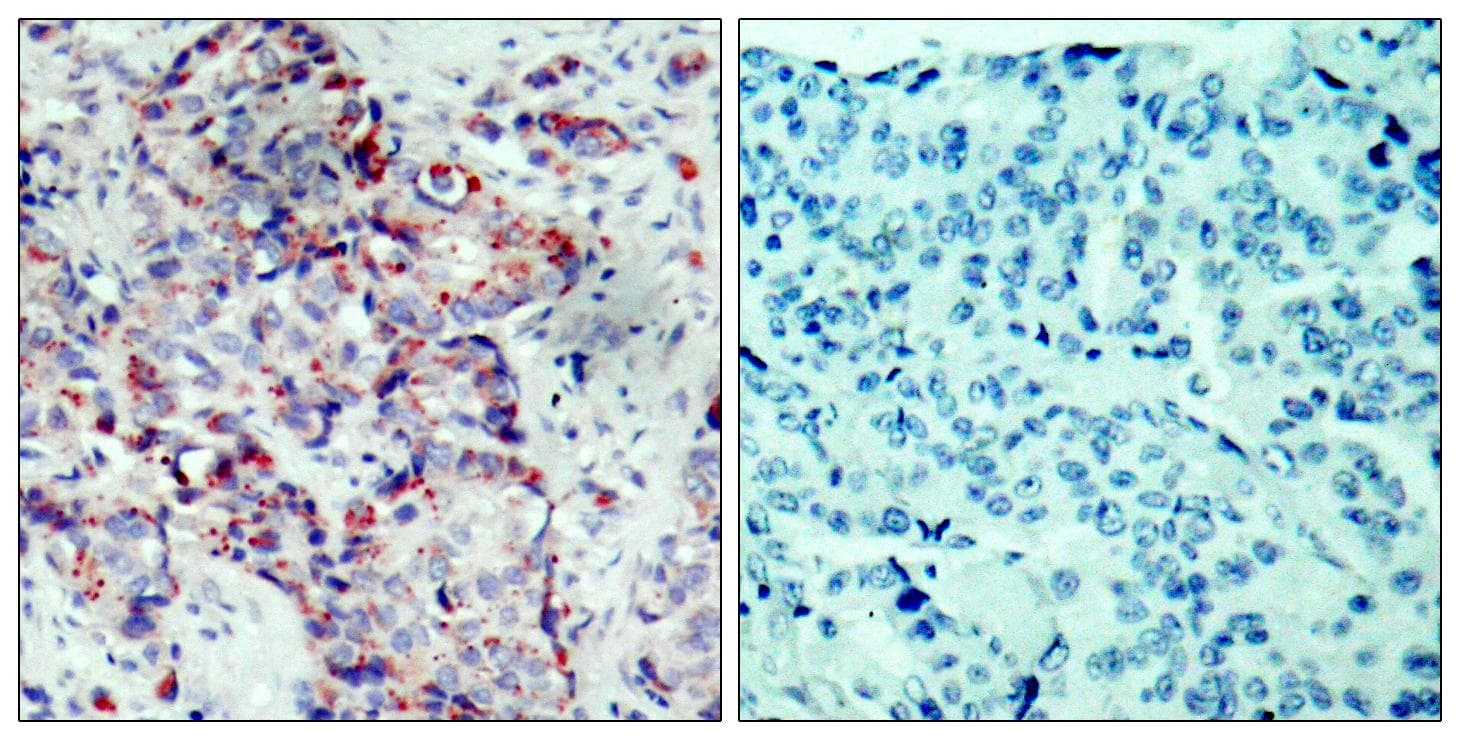 Polyclonal Rabbit anti-Human MAP2K4 / MKK4 Antibody (phospho-Ser80, IHC, WB)