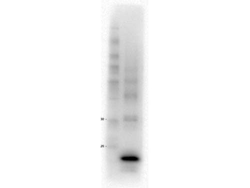 Procalcitonin Antibody (clone 11D9.F3.C12.B8)