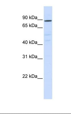 Polyclonal Rabbit anti-Human ATP6V0A2 Antibody (aa72-121, IHC, WB)