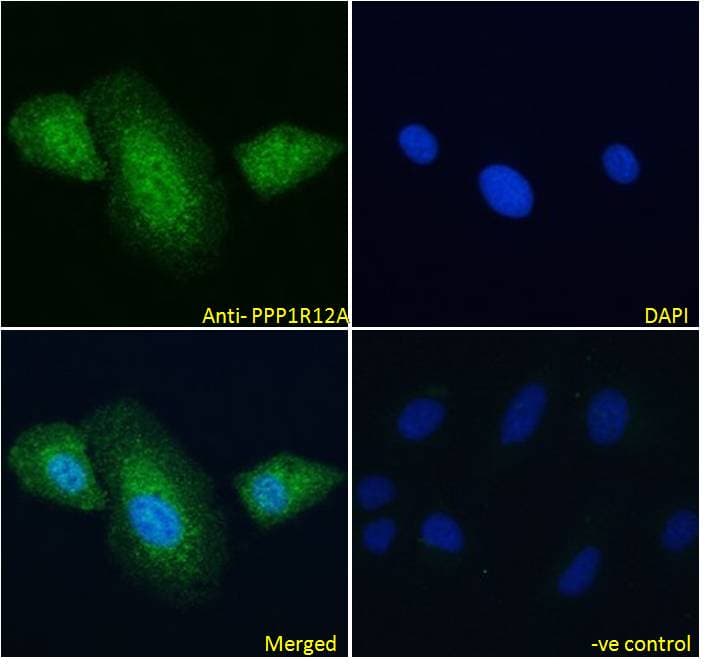 IHC-plus™ Polyclonal Goat anti-Human PPP1R12A / MYPT1 Antibody (IHC, IF)