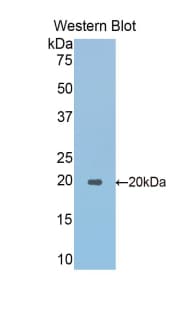 SPTAN1 / Alpha Fodrin Antibody (aa1049-1207)