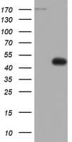 Monoclonal Mouse anti-Human TOP2A / Topoisomerase II Alpha Antibody (clone OTI2F8, aa1100-1531, IHC, WB)