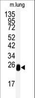 DCXR Antibody (aa79-106)