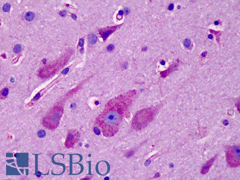 IHC-plus™ Polyclonal Rabbit anti-Human ACKR3 / CXCR7 Antibody (aa311-360, IHC, IF, WB)