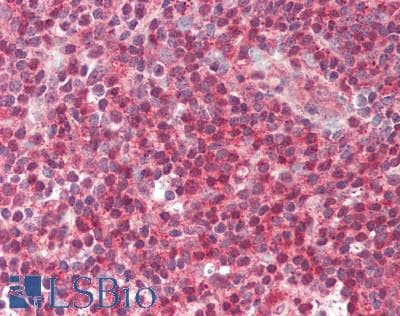 HDC / Histidine Decarboxylase Antibody (aa147-178)