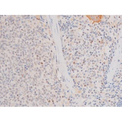 LIMK2 Antibody (phospho-Ser283)