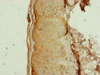 Polyclonal Rabbit anti-Human AP1M1 Antibody (IHC, WB)