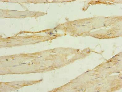 SORBS3 / Vinexin Antibody