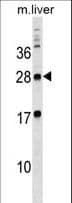 MPZL3 Antibody (aa173-202)