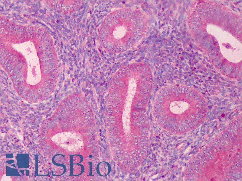 IHC-plus™ PAK2 Antibody