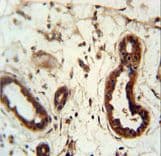 Polyclonal Rabbit anti-Human KRT82 / Keratin 82 / KRTHB2 Antibody (aa312-341, IHC, WB)
