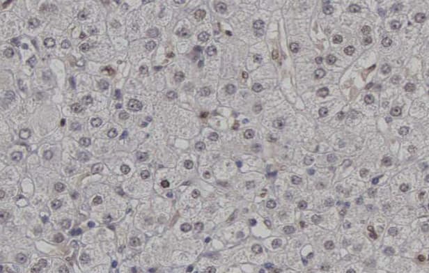 Polyclonal Rabbit anti-Human CDK2 Antibody (phospho-Thr160, IHC, IF, WB)