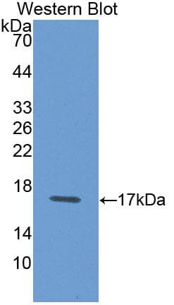 LGALS1 / Galectin 1 Antibody (aa1-135)