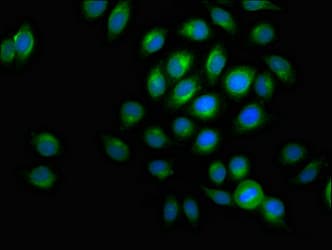 Polyclonal Rabbit anti-Human ACADVL Antibody (IHC, IF, WB)