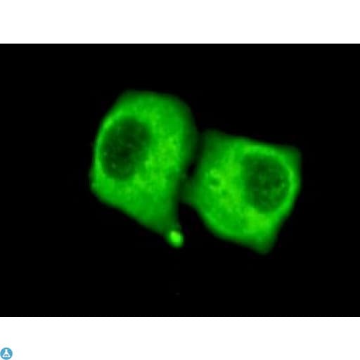 PDHA1 / PDH E1 Alpha Antibody